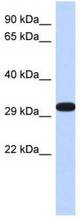 Western blot of Fetal Brain lysates
