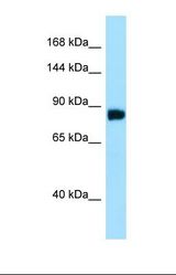 Western blot of Human HepG2. C11orf82 antibody dilution 1.0 ug/ml.
