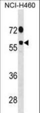 DDX19B Antibody western blot of NCI-H460 cell line lysates (35 ug/lane). The DDX19B antibody detected the DDX19B protein (arrow).