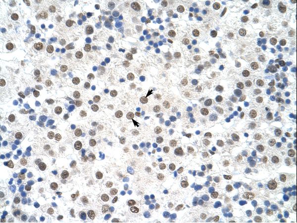 DDX19B antibody LS-C31666 was used in IHC to stain formalin-fixed, paraffin-embedded human liver.