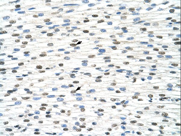 DDX19B antibody LS-C31666 was used in IHC to stain formalin-fixed, paraffin-embedded human heart.