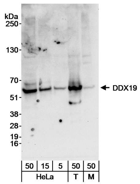 Detection of Human and Mouse DDX19 by Western Blot. Samples: Whole cell lysate from HeLa (5, 15 and 50 ug), 293T (T; 50 ug) and NIH3T3 (M; 50 ug) cells. Antibody: Affinity purified rabbit anti-DDX19 antibody used at 0.04 ug/ml for WB. Detection: Chemiluminescence with an exposure time of 30 seconds.