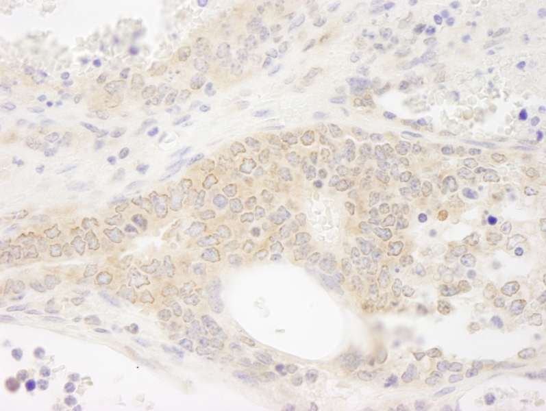 Detection of Mouse DDX19 by Immunohistochemistry. Sample: FFPE section of mouse teratoma. Antibody: Affinity purified rabbit anti-DDX19 used at a dilution of 1:250. Epitope Retrieval Buffer-High pH (IHC-101J) was substituted for Epitope Retrieval Buffer-Reduced pH.