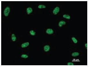 Immunofluorescent staining using DDX39 antibody. Immunostaining analysis in HeLa cells. HeLa cells were fixed with 4% paraformaldehyde and permeabilized with 0.01% Triton-X100 in PBS. The cells were immunostained with anti-DDX39 antibody.