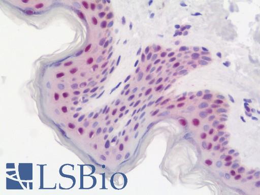 Anti-DDX39 / BAT1 antibody IHC staining of human skin. Immunohistochemistry of formalin-fixed, paraffin-embedded tissue after heat-induced antigen retrieval. Antibody LS-B10825 concentration 10 ug/ml.