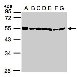 Sample (30g whole cell lysate). A:293T, B: A431 , C: H1299, D: HeLa S3 , E: Hep G2 . F: MOLT4 . G: Raji . 10% SDS PAGE. DDX39 / BAT1 antibody diluted at 1:1000