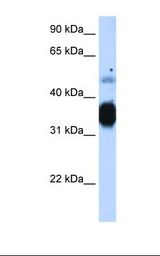 Fetal muscle cell lysate. Antibody concentration: 1.25 ug/ml. Gel concentration: 12%.