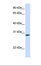 Fetal muscle lysate. Antibody concentration: 1.0 ug/ml. Gel concentration: 12%.