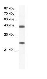 Jurkat Cell Lysate