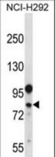 DDX3Y Antibody western blot of NCI-H292 cell line lysates (35 ug/lane). The DDX3Y antibody detected the DDX3Y protein (arrow).