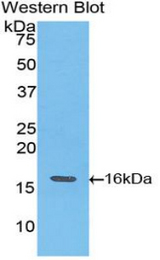 Western blot of recombinant TNNT3.