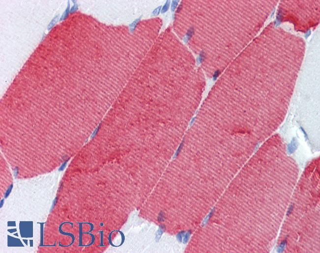 Anti-TNNT3 antibody IHC of human skeletal muscle. Immunohistochemistry of formalin-fixed, paraffin-embedded tissue after heat-induced antigen retrieval. Antibody LS-B3650 concentration 10 ug/ml.