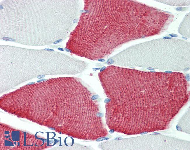Anti-TNNT3 antibody IHC staining of human skeletal muscle. Immunohistochemistry of formalin-fixed, paraffin-embedded tissue after heat-induced antigen retrieval. Antibody LS-B9570 concentration 5 ug/ml.
