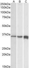 TNNT3 antibody (0.01 ug/ml) staining of Human (A), Mouse (B) and Rat (C) Skeletal Muscle lysates (35 ug protein in RIPA buffer). Primary incubation was 1 hour. Detected by chemiluminescence.