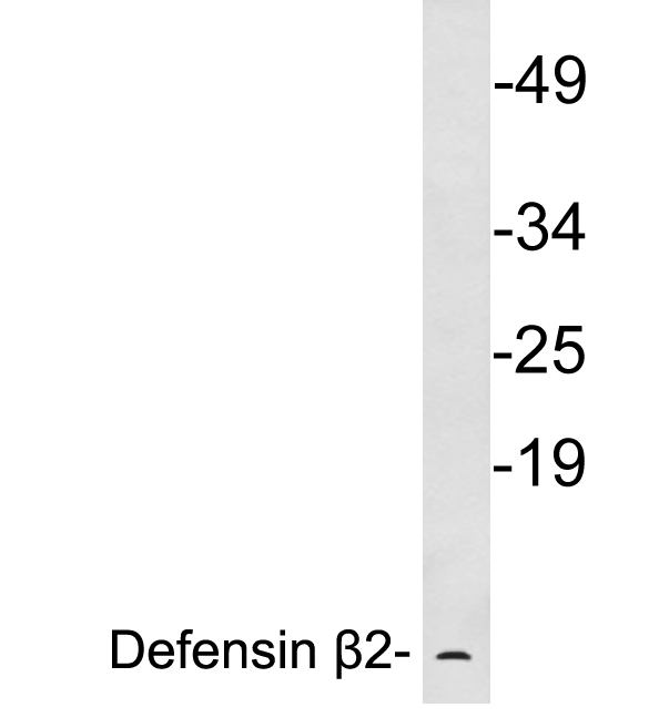 Western blot of extracts from human skin, using Defensin beta 2 antibody.