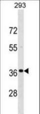 TNNT3 Antibody western blot of 293 cell line lysates (35 ug/lane). The TNNT3 antibody detected the TNNT3 protein (arrow).
