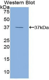 Western blot of recombinant DEFB4A / DEFB2.