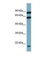 Western blot of Human PANC1 Whole cell . DESI2 antibody dilution 1.0 ug/ml.