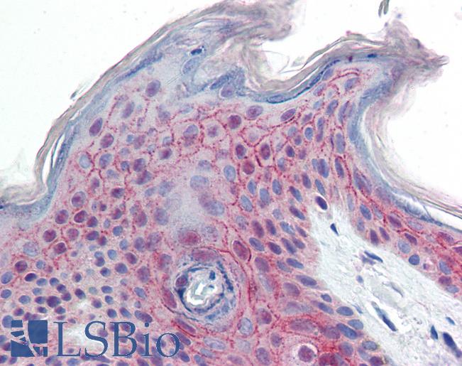 Anti-PPPDE1 antibody IHC staining of human skin. Immunohistochemistry of formalin-fixed, paraffin-embedded tissue after heat-induced antigen retrieval. Antibody LS-B9528 concentration 10 ug/ml.
