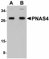 Western blot of PNAS4 in EL4 cell lysate with PNAS4 antibody at (A) 1 and (B) 2 ug/ml.
