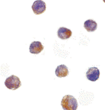 Immunocytochemistry of DFF40 in K562 cells with DFF40 antibody at 10 ug/ml.