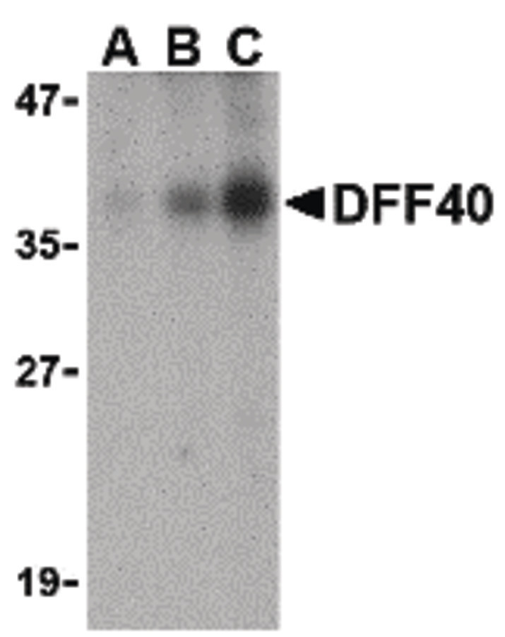 Western blot of DFF40 in Jurkat cell lysate with DFF40 antibody at (A) 0.5, (B) 1 and (C) 2 ug/ml.