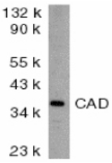Western blot of CAD in murine kidney tissue lysate with CAD antibody at 2 ug/ml.