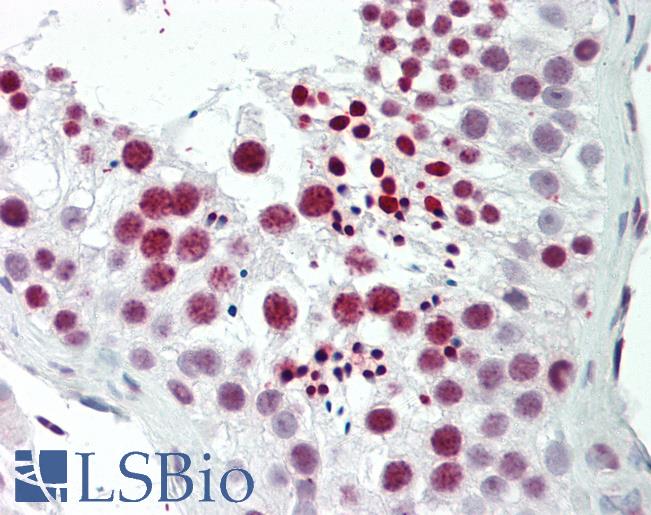 Human Testis: Formalin-Fixed, Paraffin-Embedded (FFPE)