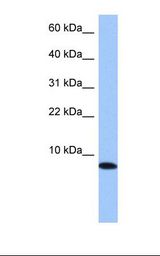 721_B cell lysate. Antibody concentration: 1.0 ug/ml. Gel concentration: 10-20%.