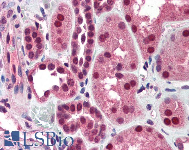 Anti-DFFB antibody IHC of human kidney. Immunohistochemistry of formalin-fixed, paraffin-embedded tissue after heat-induced antigen retrieval. Antibody LS-B559 concentration 5 ug/ml.