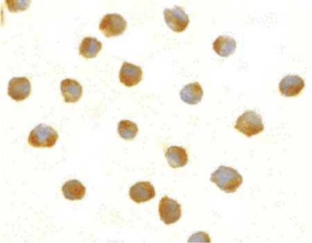 Immunocytochemistry of DFF40 in Jurkat cells with DFF40 antibody at 5 ug/ml.