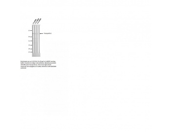 Western blot of TNPO1 / Transportin 1 antibody LS-C82235.