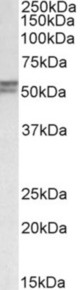 DGAT1 antibody (0.5 ug/ml) staining of Mouse Duodenum lysate (35 ug protein in RIPA buffer). Primary incubation was 1 hour. Detected by chemiluminescence.