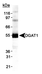 Detection of DGAT1 in HepG2 lysate.