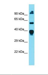 Western blot of Mouse Heart. Dgat1 antibody dilution 1.0 ug/ml.