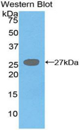 Western blot of recombinant DGAT1 / DGAT.