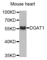 Western blot analysis of extracts of Mouse heart tissue, using DGAT1 antibody.