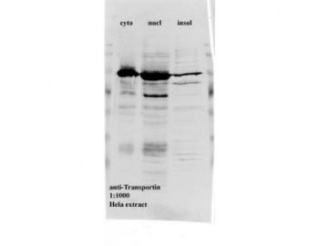 Western blot of TNPO1 / Transportin 1 antibody LS-C82277.