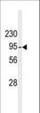 Western blot of anti-hDGKB-T787 antibody in mouse liver tissue lysate. hDGKB-T787(arrow) was detected using the purified antibody.