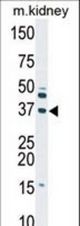 Western blot of anti-DGUOK antibody in mouse kidney tissue lysate (35 ug/lane). DGUOK(arrow) was detected using the purified antibody.