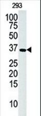 Western blot of anti-hDGUOK-M1 antibody in 293 cell line lysate (35 ug/lane). hDGUOK-M1(arrow) was detected using the purified antibody.