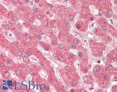 Human Liver: Formalin-Fixed, Paraffin-Embedded (FFPE)