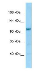 DIA / DIAPH2 antibody Western Blot of Rat Brain.