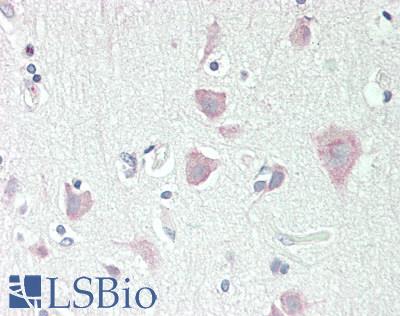 Human Brain, Cortex: Formalin-Fixed, Paraffin-Embedded (FFPE)