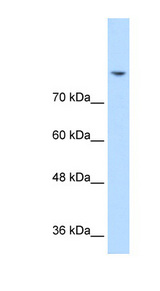 Western blot of Jurkat lysate using Anti-DLG2 Antibody.