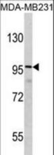 Western blot of DLGAP1 Antibody in MDA-MB231 cell line lysates (35 ug/lane). DLGAP1 (arrow) was detected using the purified antibody.