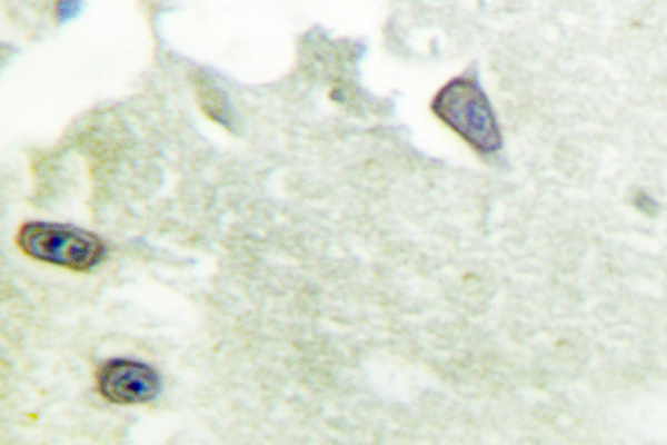 IHC of OPG SAPAP1 (E817) pAb in paraffin-embedded human brain tissue.
