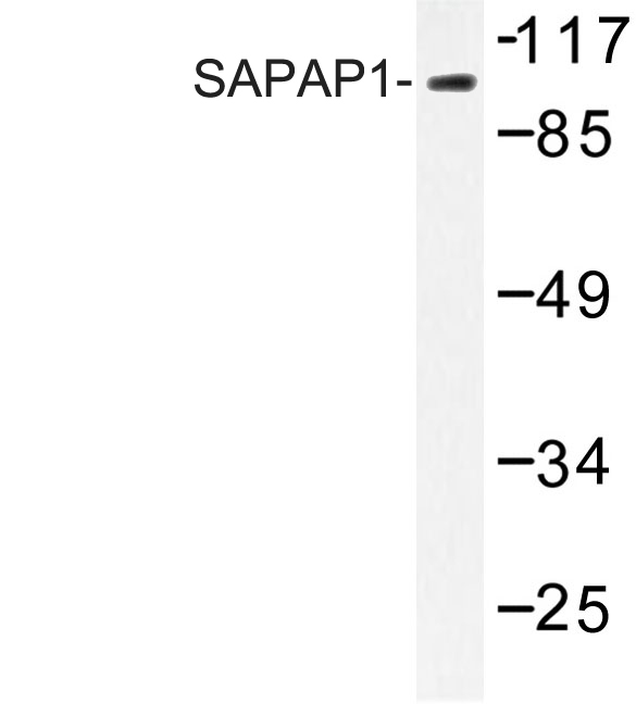 Western blot of SAPAP1 (E817) pAb in extracts from HepG2 cells.