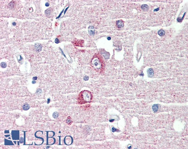 Anti-DLGAP1 antibody IHC of human brain, cortex. Immunohistochemistry of formalin-fixed, paraffin-embedded tissue after heat-induced antigen retrieval. Antibody LS-B4171 concentration 3.75 ug/ml.