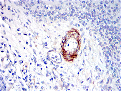 IHC of paraffin-embedded human esophagus tissues using GKAP mouse monoclonal antibody with DAB staining.